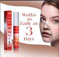 Lovilds Warts & Tags Remover Pen- Buy 1 Get 1 Free